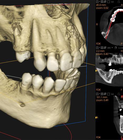 Imagerie d'un examen CBCT